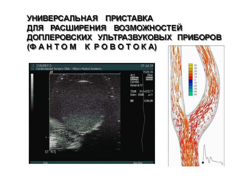 УНИВЕРСАЛЬНАЯ ПРИСТАВКА ДЛЯ РАСШИРЕНИЯ ВОЗМОЖНОСТЕЙ ДОПЛЕРОВСКИХ УЛЬТРАЗВУКОВЫХ УНИВЕРСАЛЬНАЯ ПРИСТАВКА ДЛЯ РАСШИРЕНИЯ ВОЗМОЖНОСТЕЙ ДОПЛЕРОВСКИХ УЛЬТРАЗВУКОВЫХ